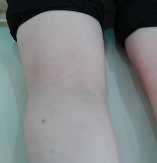 AFTER 이미지