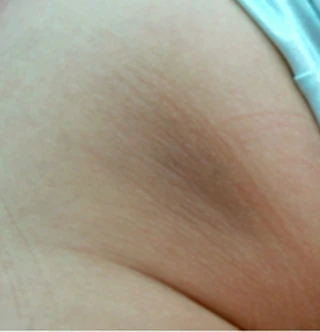 BEFORE 이미지