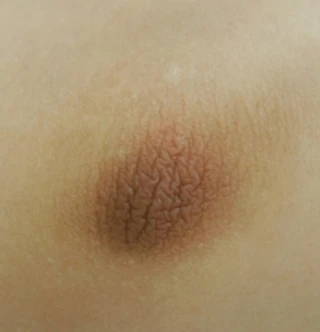 BEFORE 이미지