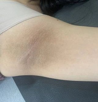 BEFORE 이미지
